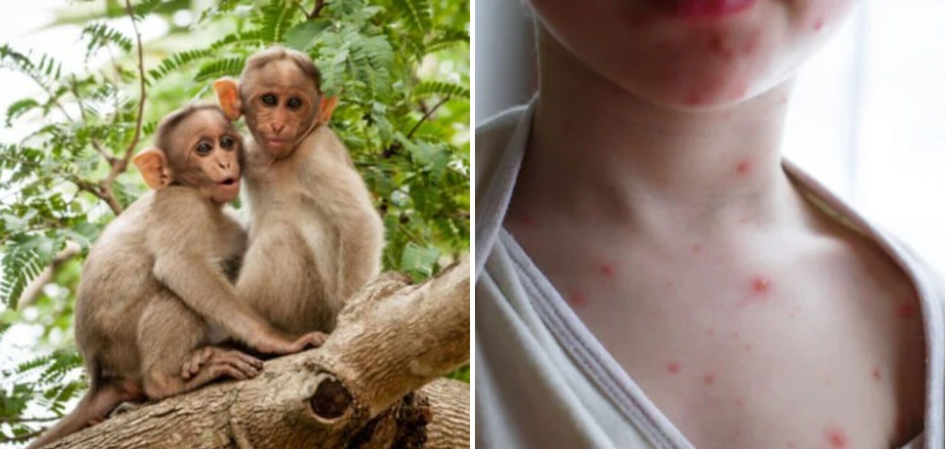 Контактным лицам не обязательно уходить на изоляцию