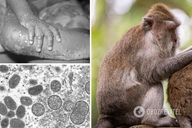 ВОЗ подтвердила 780 случаев заражения оспой обезьян