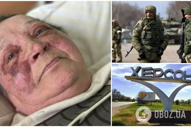 В Херсоне россияне жестоко избили журналистку из-за нежелания отдать паспорт Украины. Фото