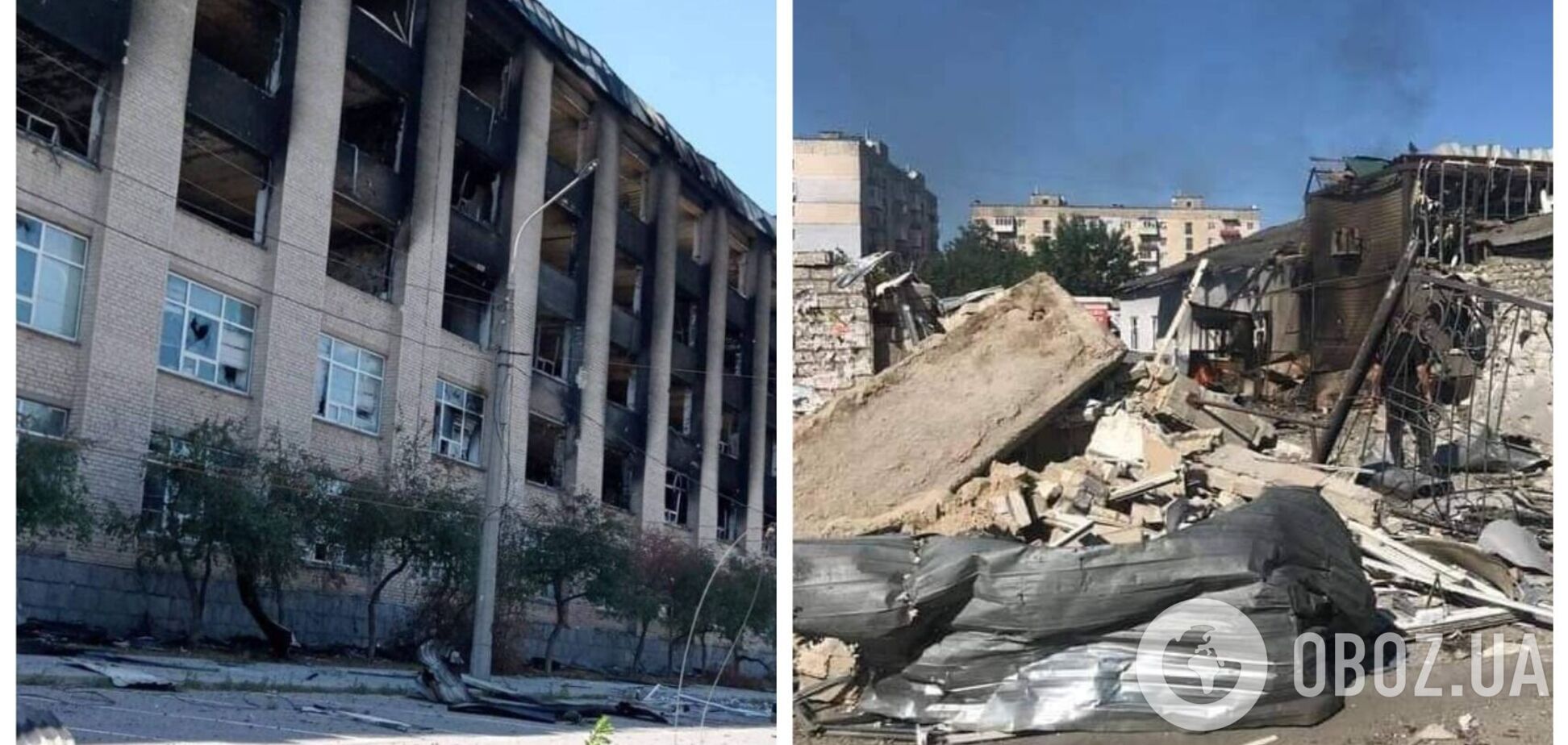 Окупанти не зупиняються ні перед чим: Гайдай розповів про стан поранених від обстрілу в Лисичанську. Фото