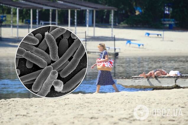 В Киеве на пляжах нашли кишечную палочку