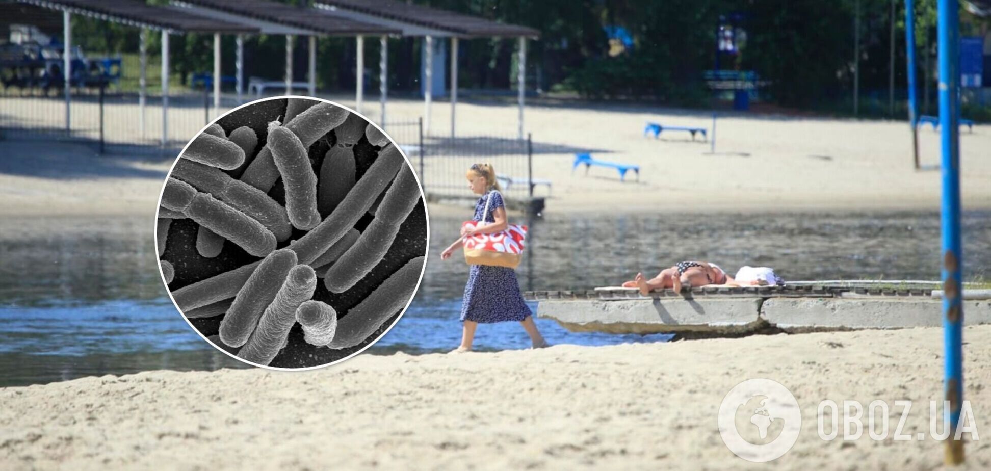 В Киеве на пляжах нашли кишечную палочку