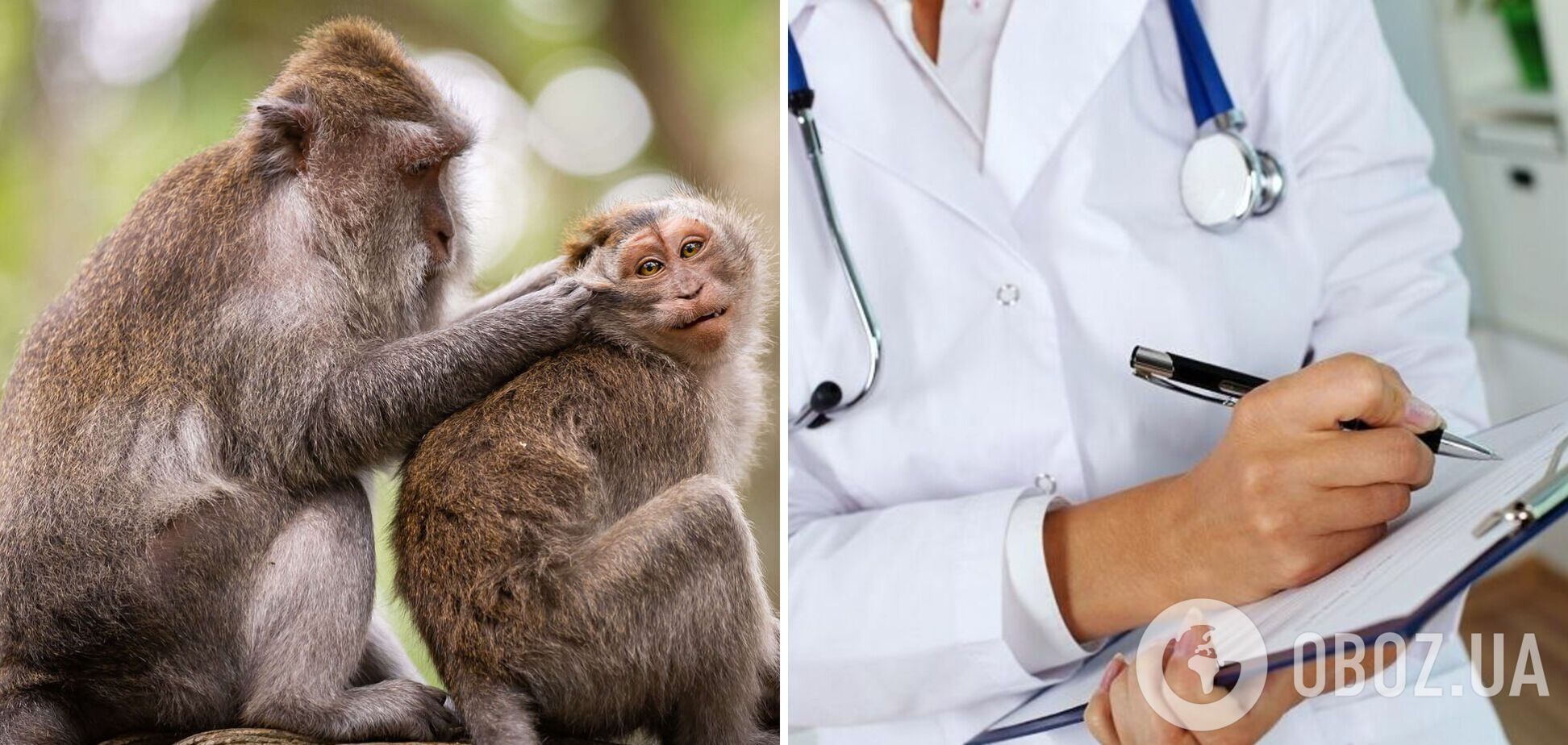 В Турции диагностировали оспу обезьян