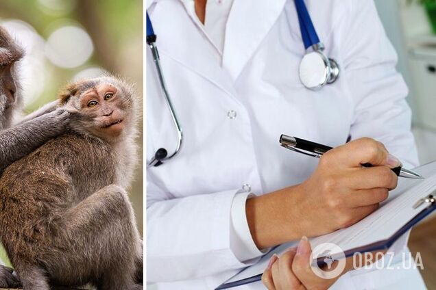 В Турции диагностировали оспу обезьян