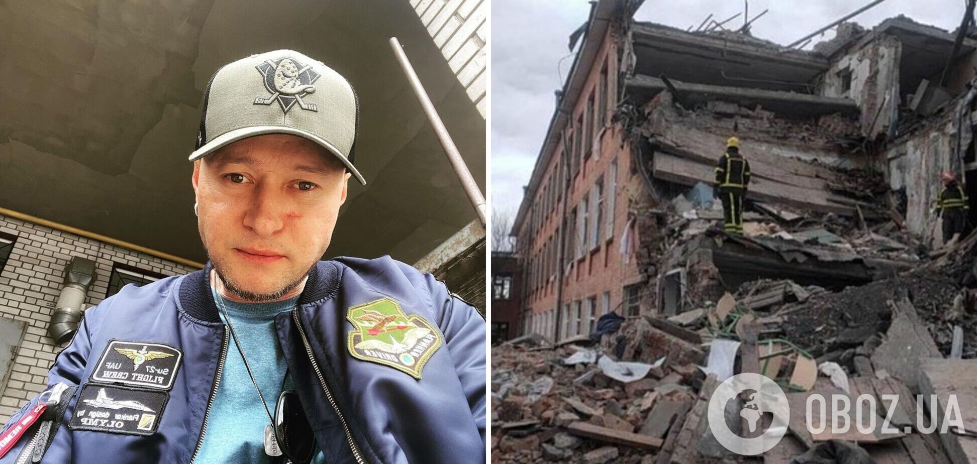 Хлывнюк впервые признался, как получил ранение в лицо: будто сбили с ног