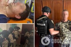 В Броварах злоумышленник открыл стрельбу среди белого дня: ранение получил 31-летний мужчина, стрелка уже задержали. Фото и видео 18+