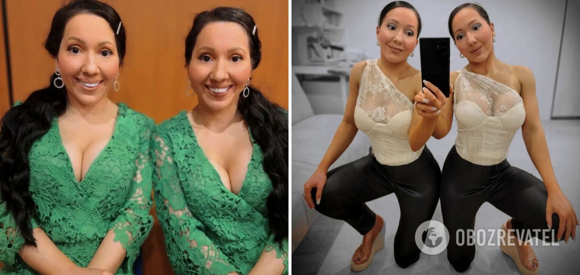 'Самые похожие близнецы в мире' решили родить ребенка от одного и того же мужчины. Фото