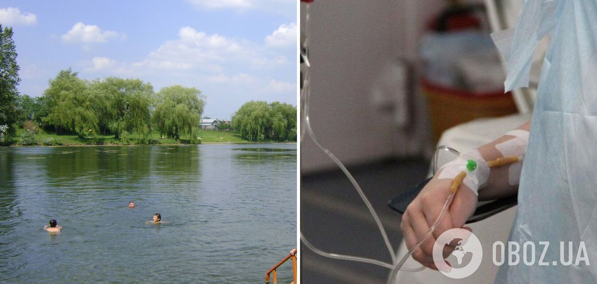 На Київщині підліток помер від лептоспірозу, який підхопив у водоймі: що відомо про хворобу і як можна нею заразитися