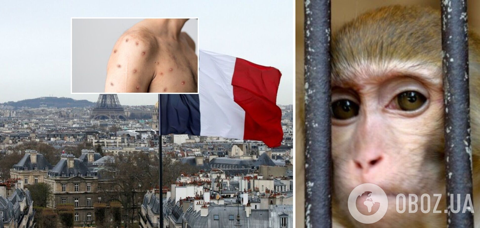 У Франції вже понад 1700 випадків захворювання на віспу мавп: у країні відкриють спеціальний центр вакцинації