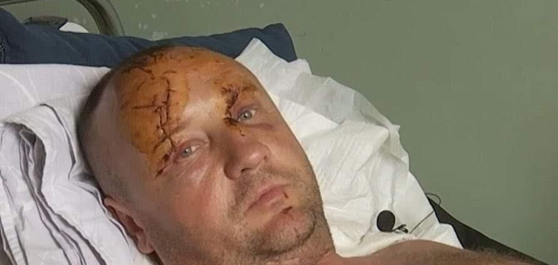 Выжил в 'Амсторе': житель Кременчуга поделился историей с Музеем 'Голоса Мирных'