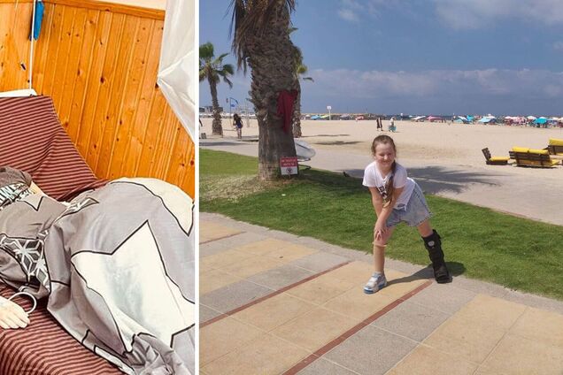 В Израиле вылечили попавшую под российский обстрел девочку из Чернигова