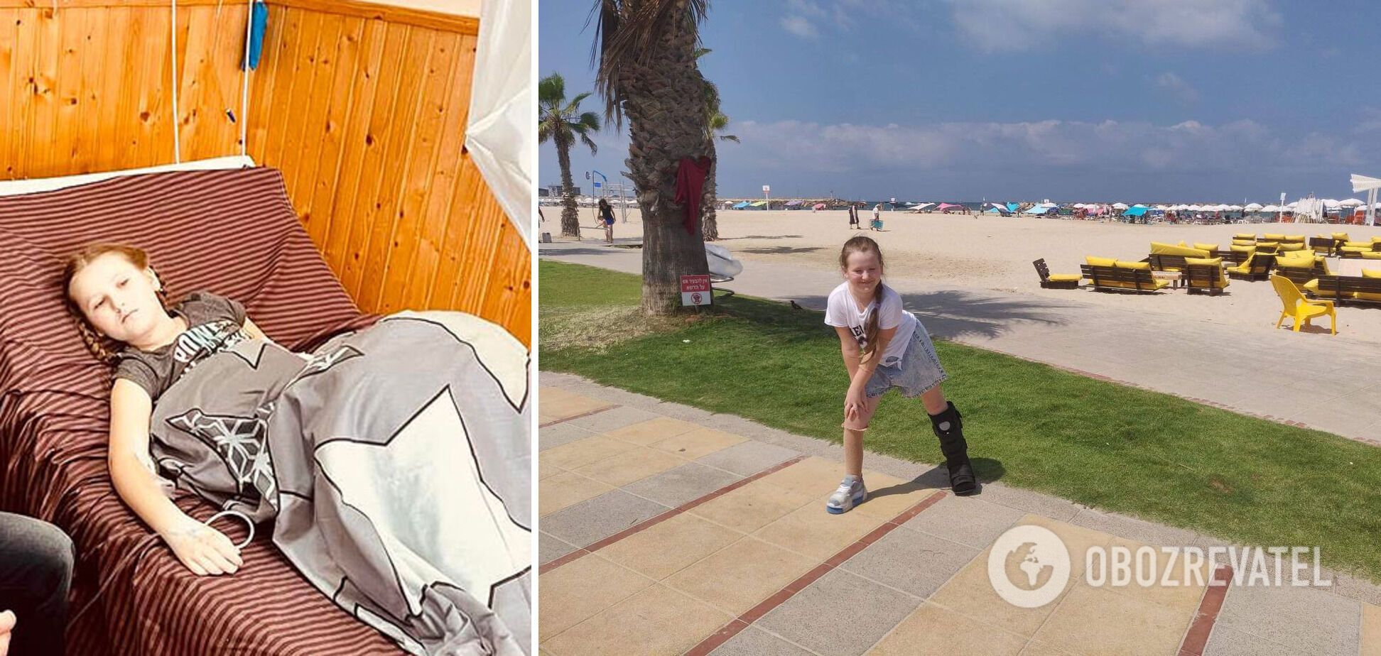 В Ізраїлі вилікували дівчинку з Чернігова, яка потрапила під російський обстріл