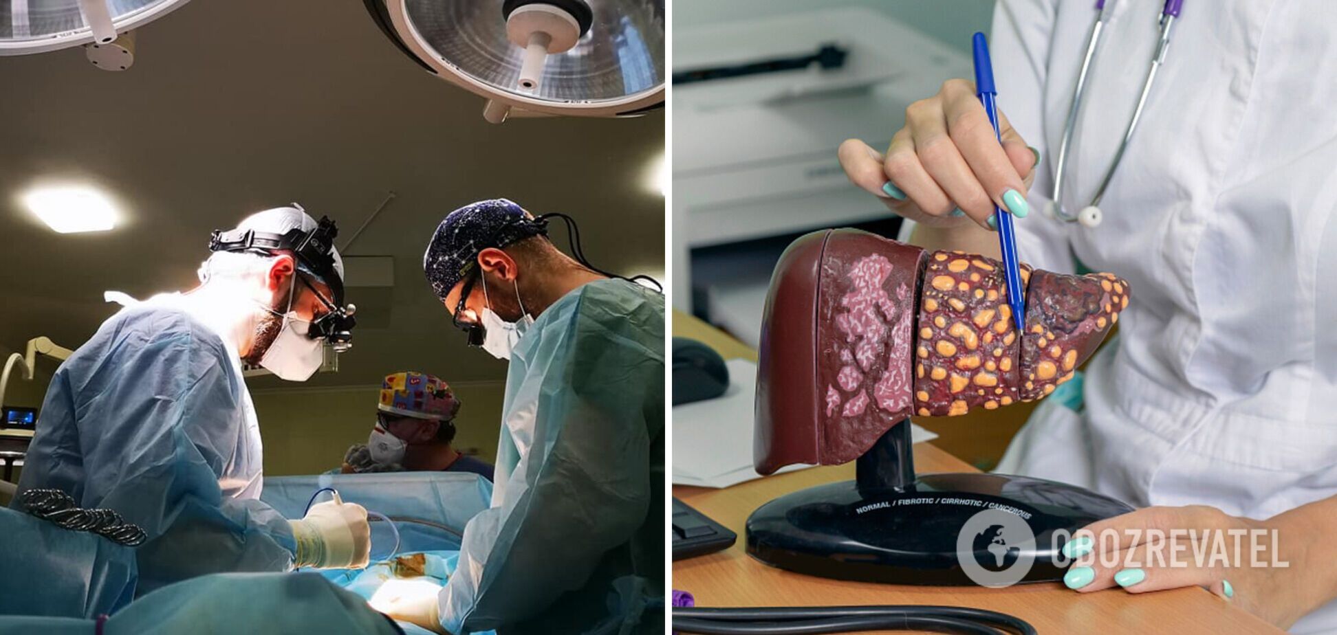 Лікарі наблизилися до вирощення нової печінки в організмі людини: метод стане революційним