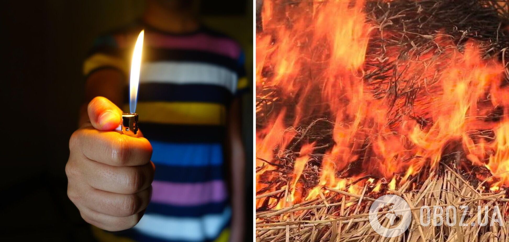 В Одессе умер 4-летний мальчик, получивший ожоги 98% тела во время игры с зажигалкой