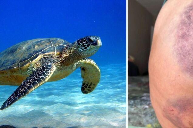 На популярному курорті Туреччини величезна черепаха покусала російську туристку. Фото