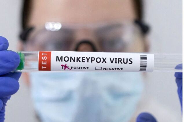 В США объявили чрезвычайную ситуацию из-за распространения обезьяньей оспы