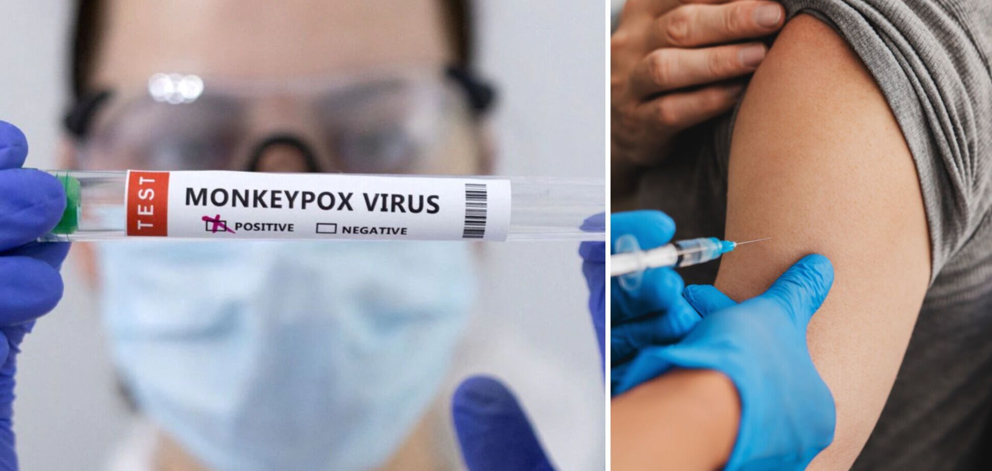 У США оголосили надзвичайну ситуацію через поширення мавпячої віспи