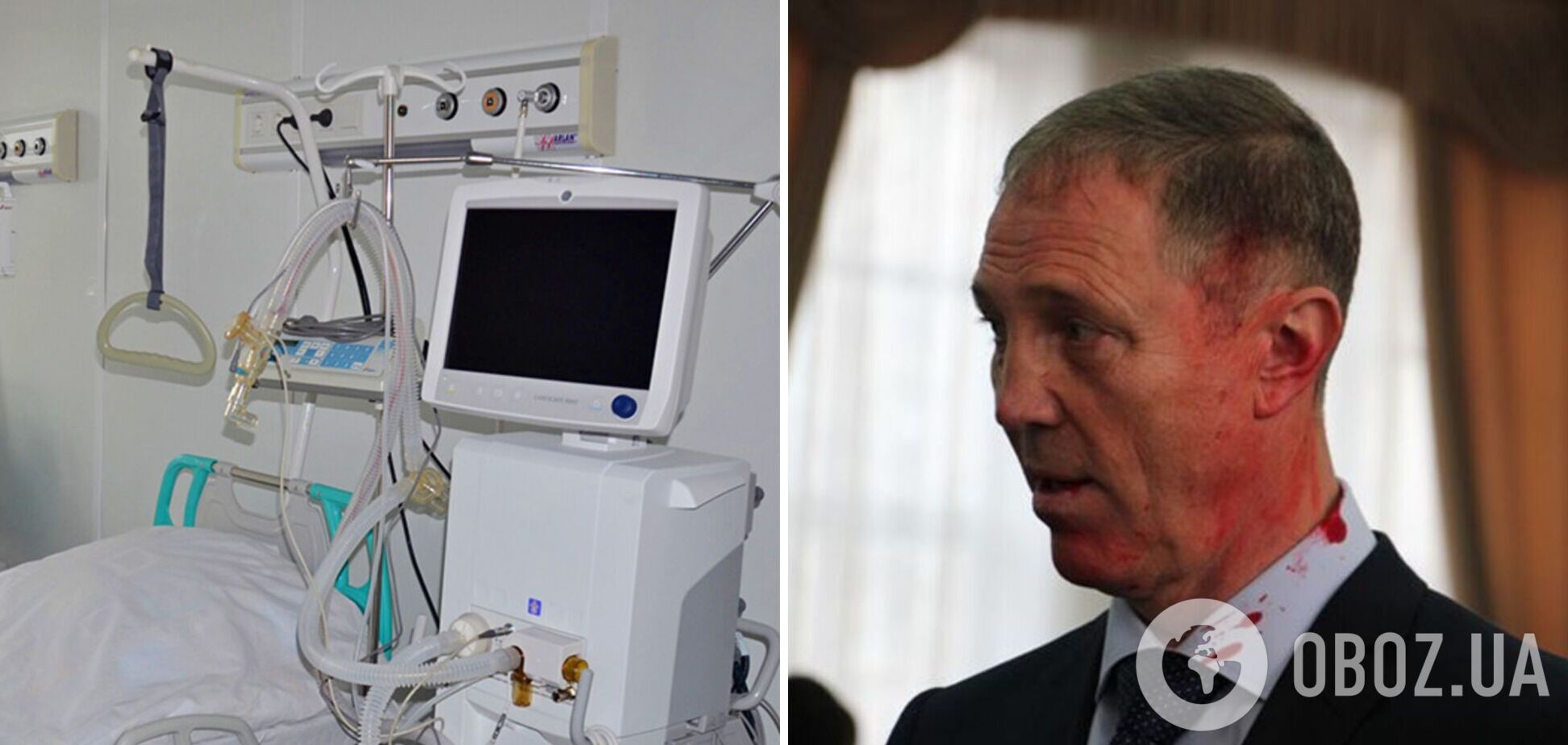 Під'єднали до ШВЛ і ввели в кому: пропагандисти заявили про погіршення стану 'гауляйтера' Сальдо