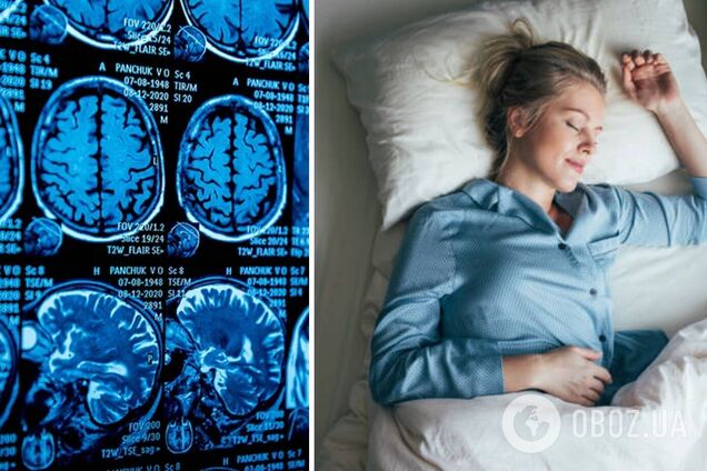 Що відбувається з мозком, коли ми спимо: дослідники розкрили таємницю