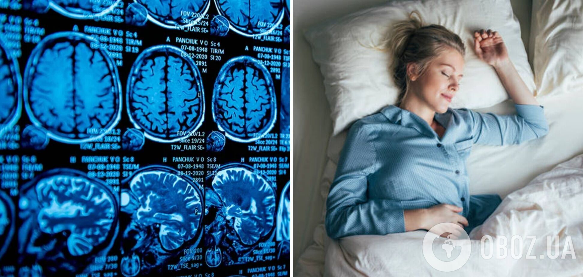 Що відбувається з мозком, коли ми спимо: дослідники розкрили таємницю