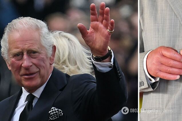 Как сосиски. Сеть смутили отекшие пальцы Чарльза ІІІ