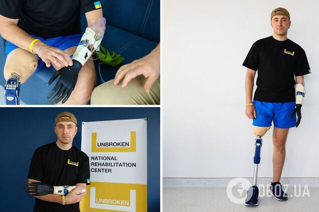 Защитник Украины, потерявший руку и ногу под Изюмом, получил бионический протез. Фото