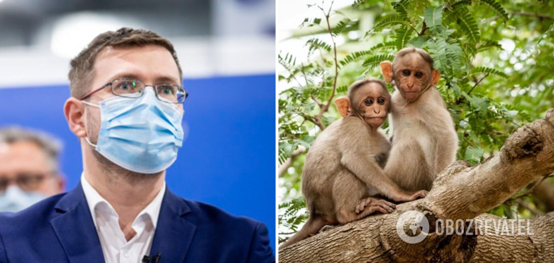 Головний санлікар розповів, чи загрожує Україні епідемія мавпячої віспи 