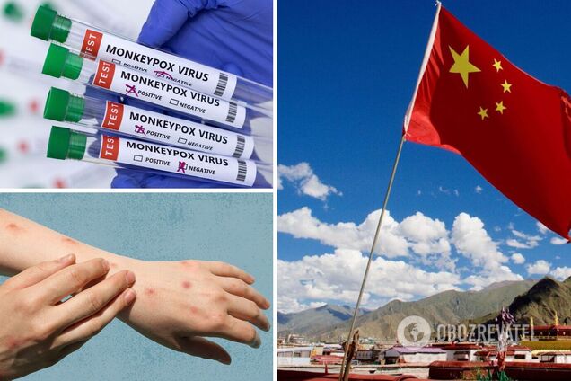 Віспа мавп у Китаї