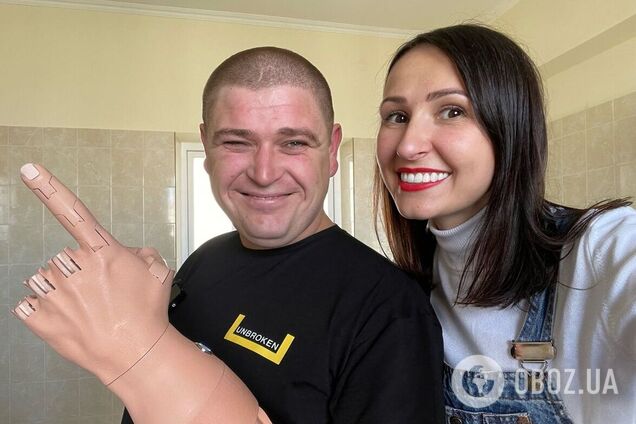 100 украинцев получат самые легкие в мире бионические протезы конечностей от Unlimited Tomorrow