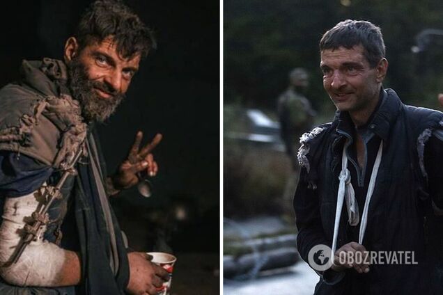 'В руці не вистачає 4 см кістки': стало відомо про стан захисника 'Азовсталі' Михайла Діанова, якого повернули з полону РФ. Фото