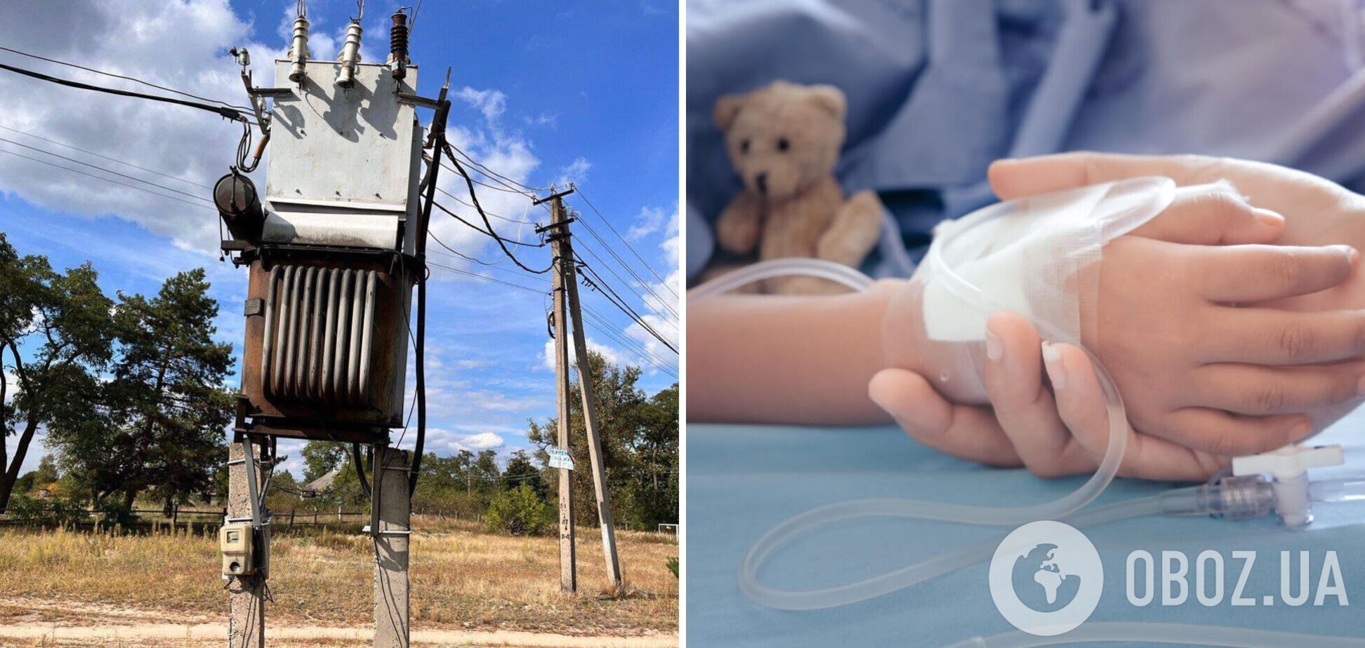 Чудом выжил: под Киевом 7-летний мальчик получил удар током, пробравшись в электротрансформатор