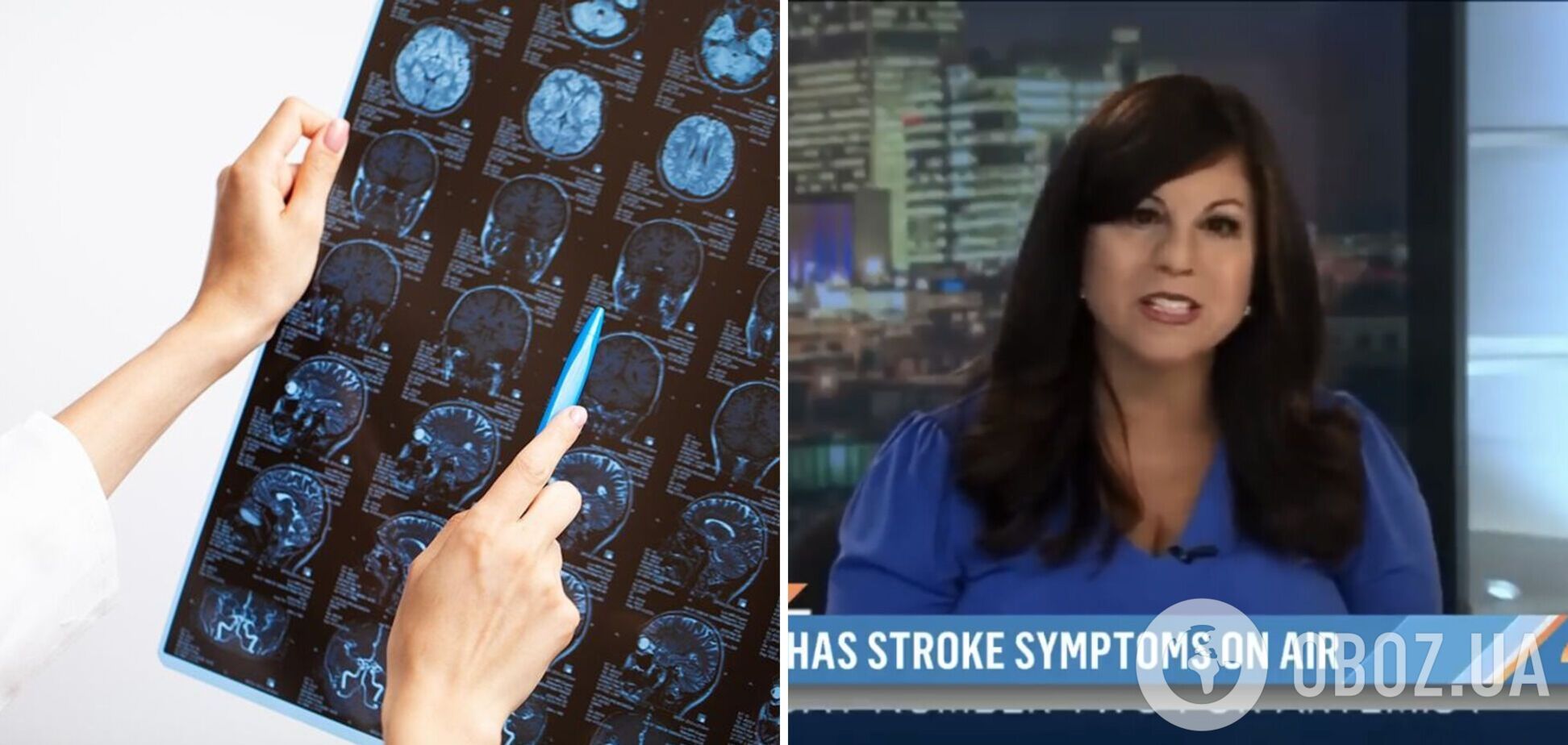 В американської ведучої стався 'початок інсульту' в прямому ефірі: заніміла рука, відняло мову. Відео