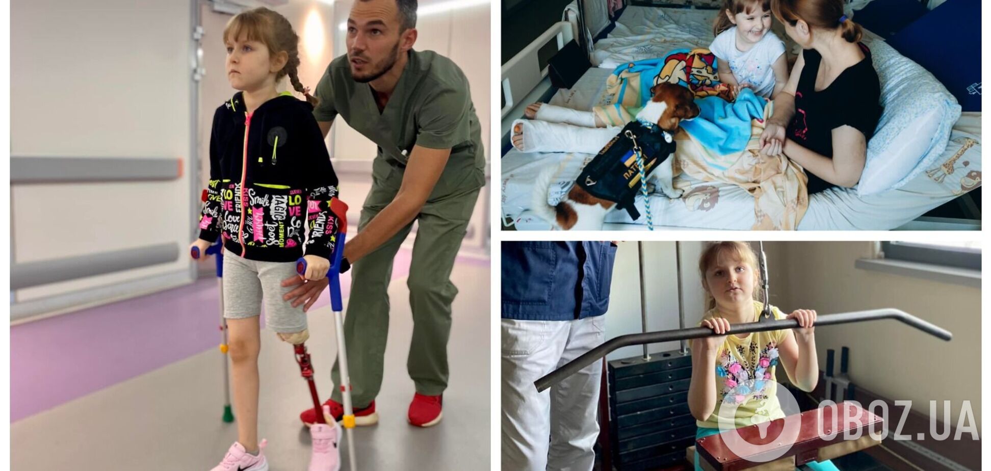 6-річна дівчинка з Херсонщини, яка втратила ногу через ракетний удар РФ, зробила перші кроки на протезі. Фото 