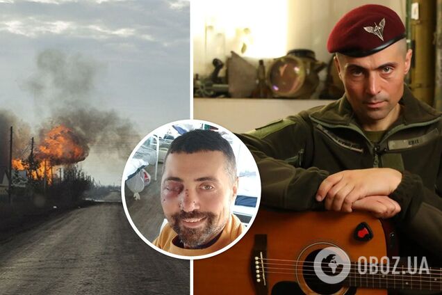 Актер-воин Линартович опубликовал свое первое фото после тяжелого ранения под Бахмутом: попытки улыбнуться