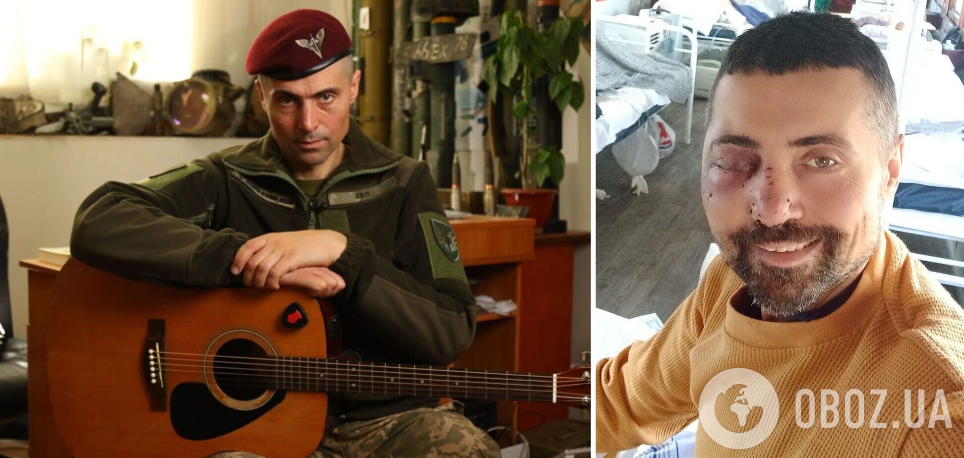 Актор-воїн Лінартович розповів, як отримав тяжке поранення під Соледаром, і назвав найтяжчий момент на фронті