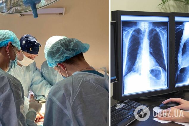 Тривала 16 годин: у Львові провели унікальну операцію з пересадки легень від посмертного донора