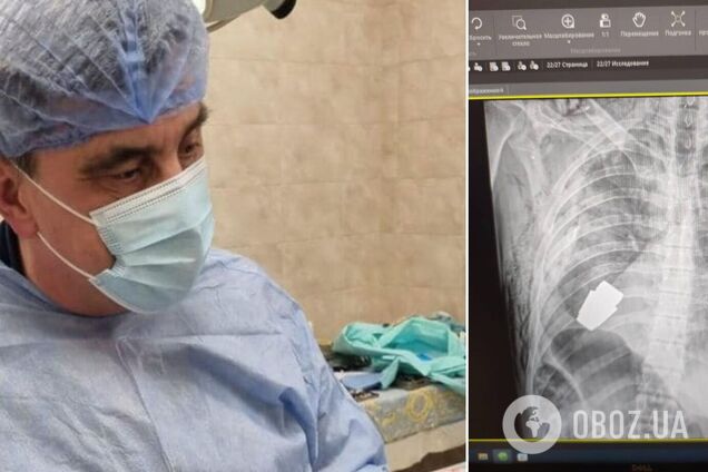 Украинские хирурги провели уникальную операцию и достали из тела военнослужащего неразорвавшуюся гранату ВОГ. Фото