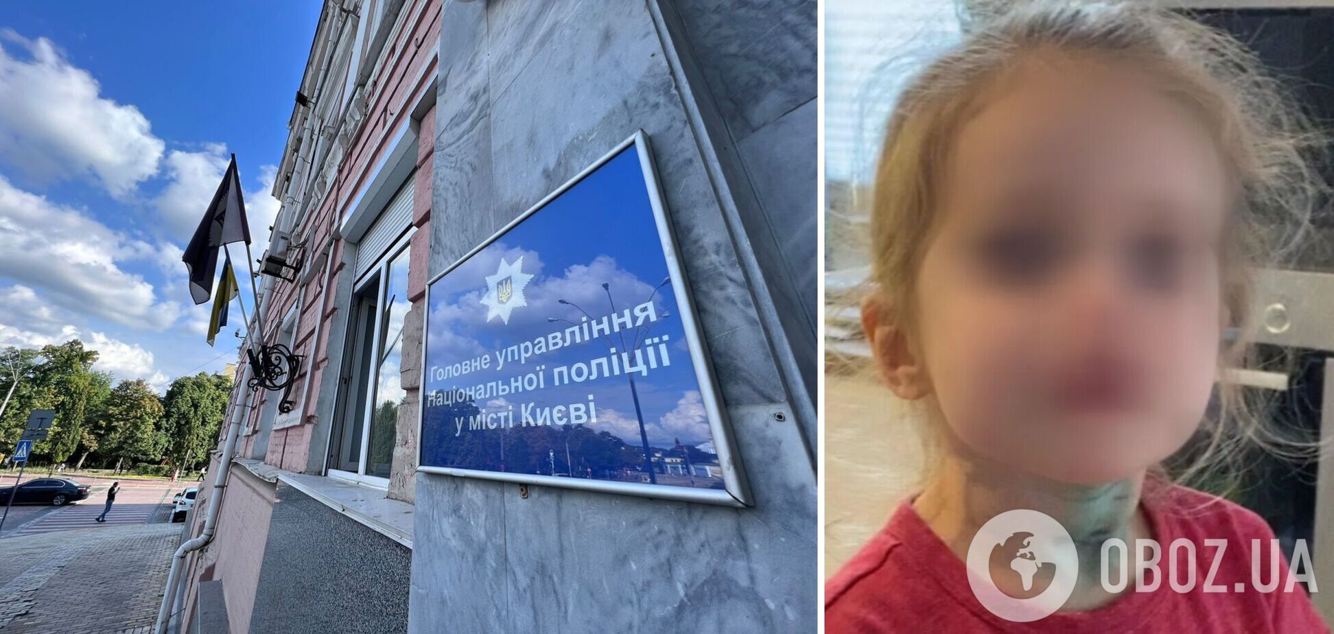 Поліція розслідує факт нанесення легких тілесних ушкоджень