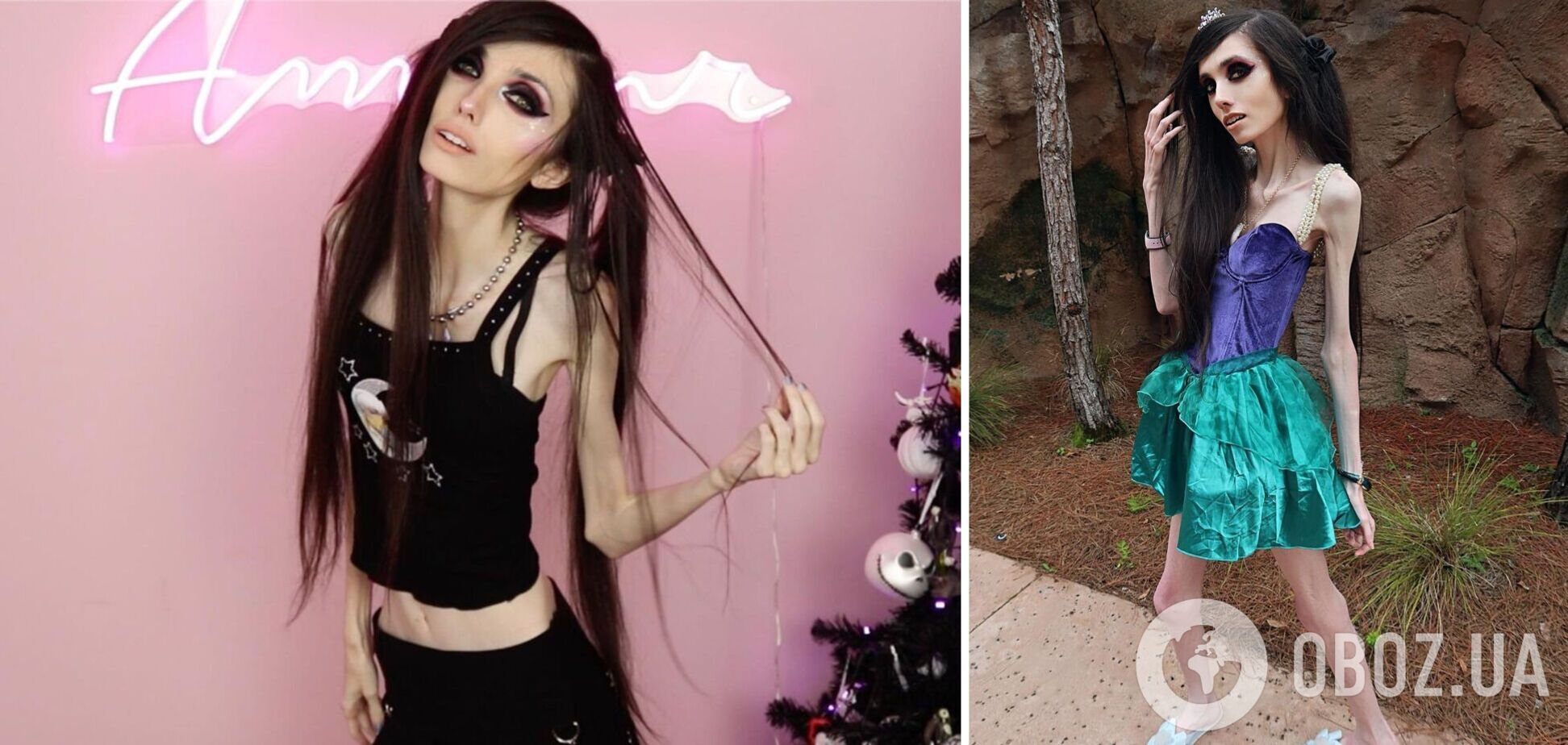 Звезда TikTok, страдающая анорексией, смутила поклонников новыми видео: как выглядит 29-летняя девушка