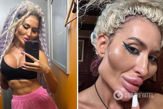 Увеличила грудь и собирается в церковь: как выглядит сейчас Анастасия Покрищук – украинка с самыми большими скулами в мире