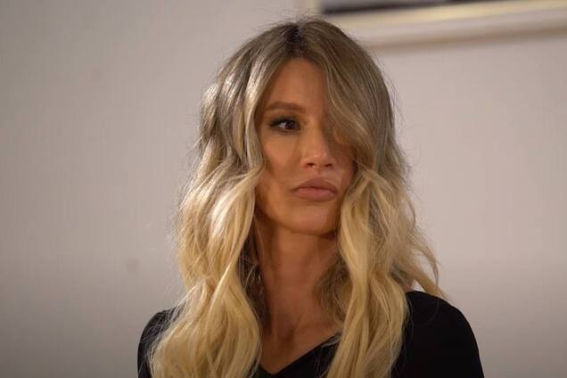 'Світ має приймати поранених такими як є': українка, яка після втрати ока знялася для Playboy, довірила свою історію музею 'Голоси Мирних'