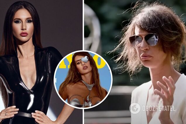 Где сейчас и как изменилась украинская модель Playboy Инна Белоцерковец, потерявшая глаз из-за России. Фото и видео
