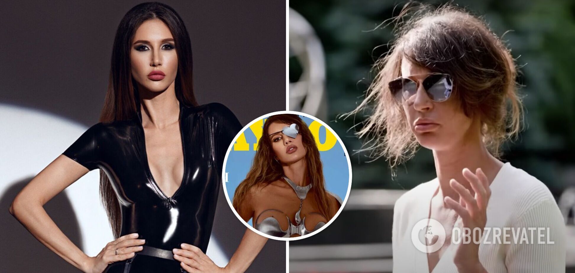 Де зараз і як змінилася українська модель Playboy Інна Білоцерковець, яка втратила око через Росію. Фото і відео