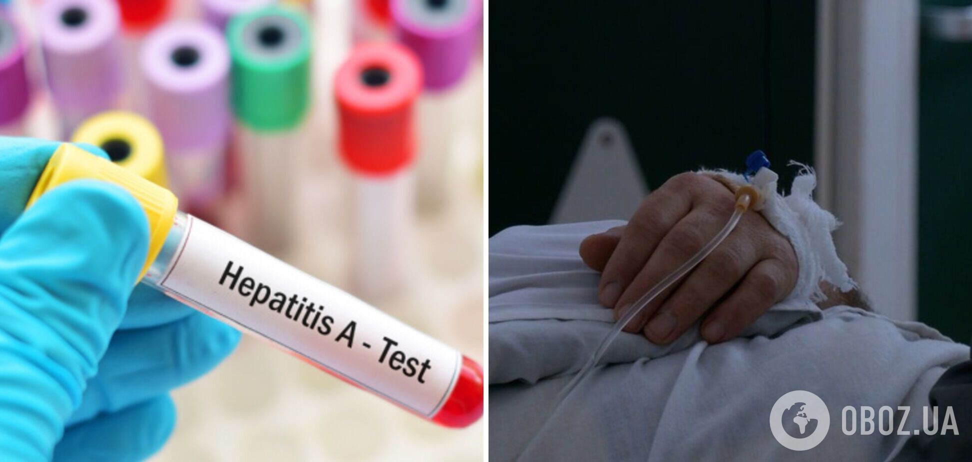 Гепатит А уже обнаружили в Ивано-Франковске: как уберечься