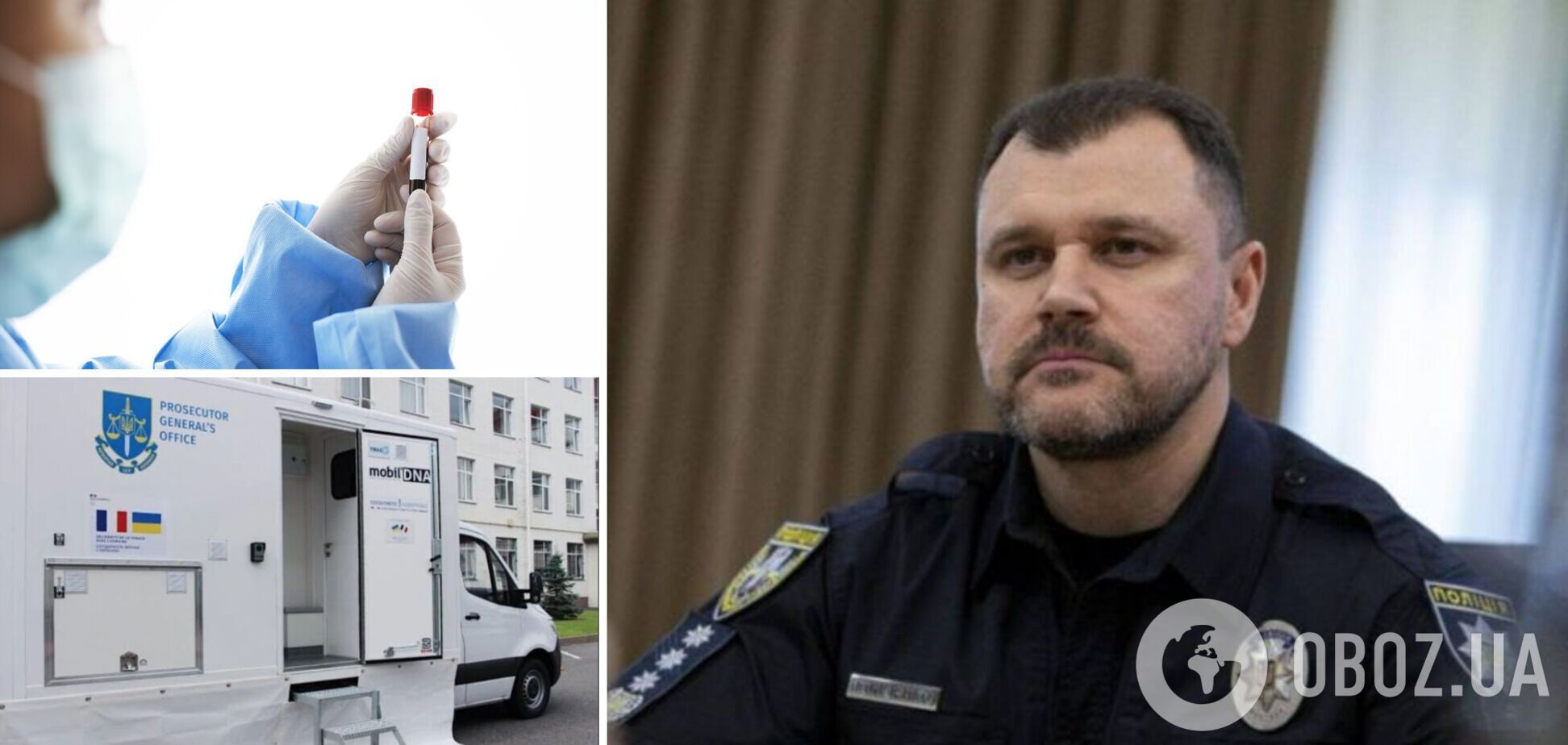 Украинцы в Европе смогут сдать образцы ДНК для поиска пропавших родственников: в МВД объяснили процедуру