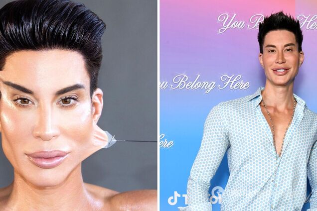 Как выглядит сегодня живой Кен Джастин Джедлика: сделал более 1000 пластических операций за миллион долларов