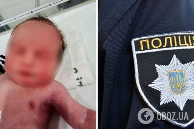 Має ще чотирьох дітей: поліцейські встановили матір, яка викинула немовля на смітник на Полтавщині