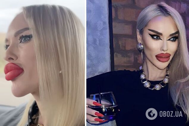 'Королева ДНР' Аліна Андрієвська пояснила, чому в неї такі великі губи. Відео