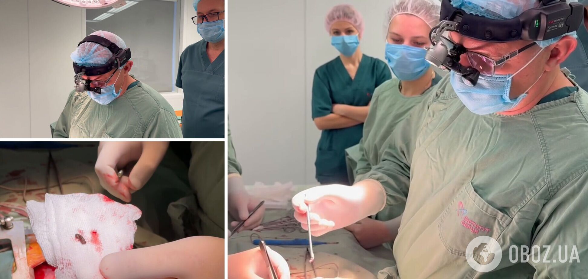 Попала под обстрел в Херсоне: из сердца четырехлетней девочки достали обломок российской мины. Видео