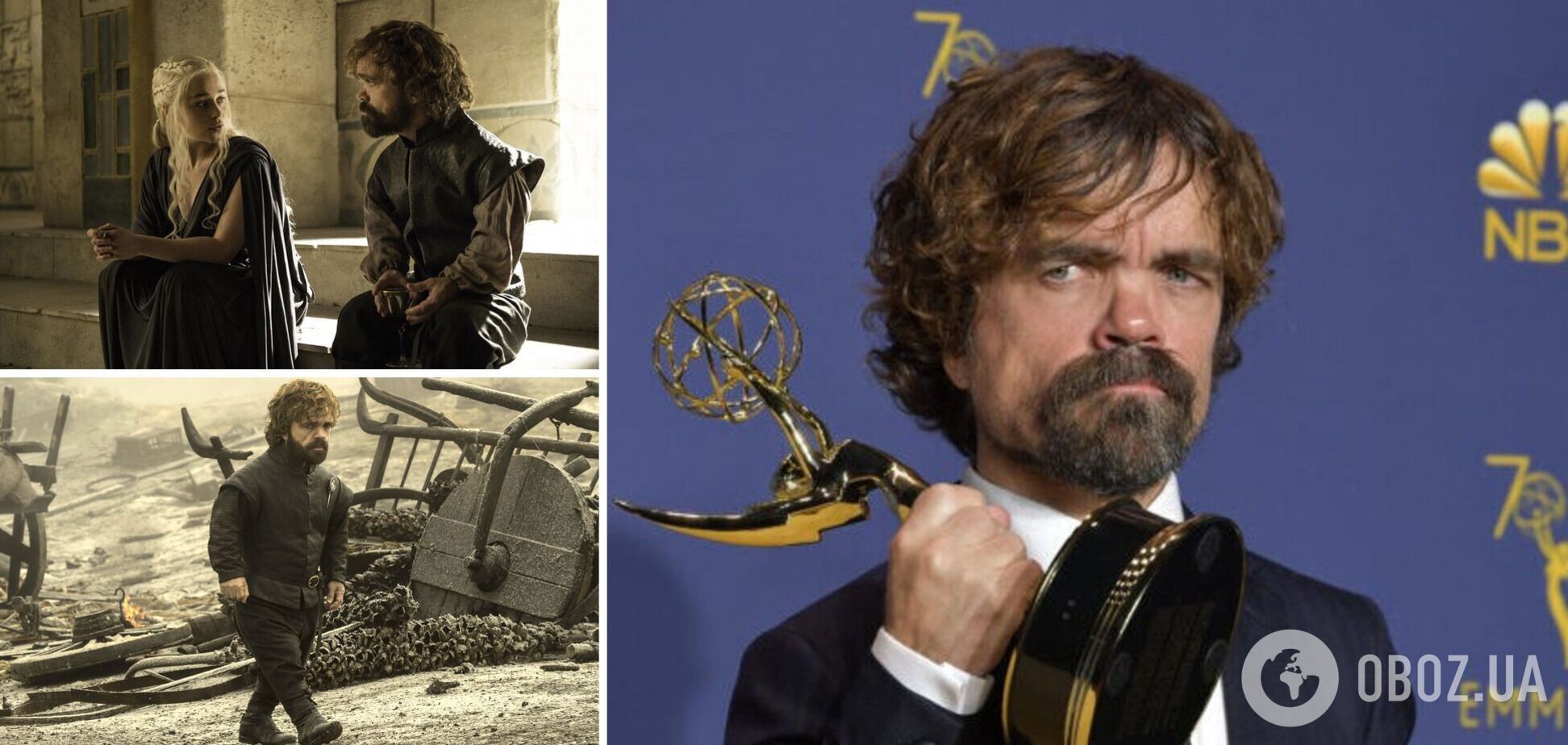 Жив у квартирі з щурами та без опалення, і ніхто в нього не вірив: як актор зі зростом 135 см підкорив Голлівуд